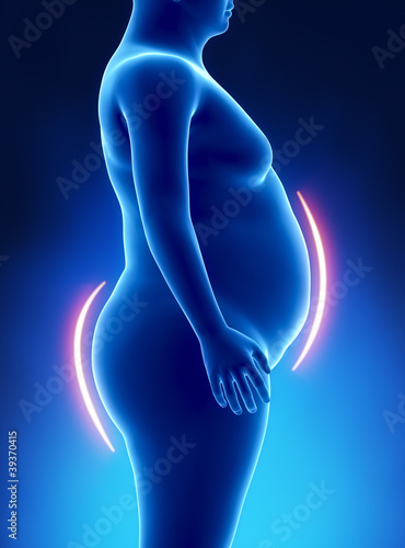 Illustration: Obesity female fat lines Obesity female fat lines