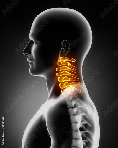 Illustration: Cervical spine anatomy lateral view Cervical spine anatomy lateral view