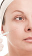 Woman with marks drawn on face during botox procedure Woman with marks drawn on face during botox procedure