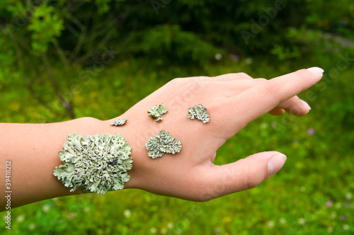 Photo: lichen on the hand of young woman symbolizing a skin disease lichen on the hand of young woman symbolizing a skin disease