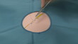 Surgeon  exercising stitching, finishing a double stitch