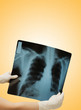 Two hands holding x-ray image of human body
