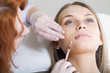 botox or hyaluronic acid injection