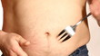 Overweight man