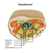 Illustration: karpaltunnel karpaltunnel
