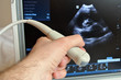 Photo: Microconvex ultrasound probe with abdominal scan background Microconvex ultrasound probe with abdominal scan background