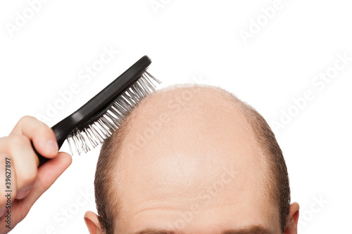 Photo: Bald man head Bald man head