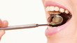 Video: Woman teeth with a dental mirror. Woman teeth with a dental mirror.