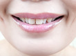 Photo: Lips of an Asian young woman. Lips of an Asian young woman.