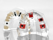 artificial jaw