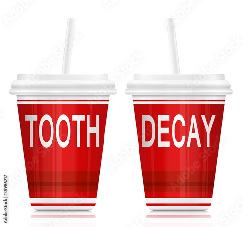 Illustration: Tooth decay concept. Tooth decay concept.