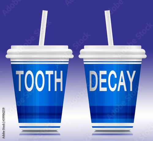 Illustration: Tooth decay concept. Tooth decay concept.