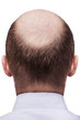 Bald man head
