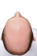 Bald man head