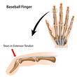 Baseball finger, eps8