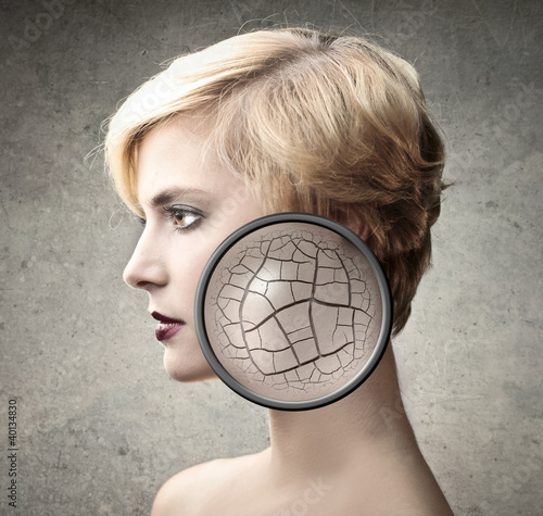 Photo: Problem skin Problem skin