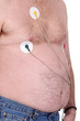 Electrocardiogram, Holter Monitor for heart activity