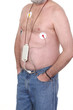 Photo: Electrocardiogram, Holter Monitor for heart activity Electrocardiogram, Holter Monitor for heart activity
