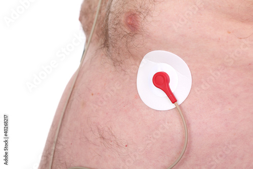 Photo: Electrocardiogram, Holter Monitor for heart activity Electrocardiogram, Holter Monitor for heart activity