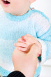 Brandverletzungen bei Kindern