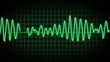 EKG Screen