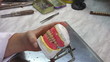 Making denture, close-up
