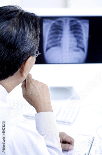 Photo: Doctor studying an x-ray picture Doctor studying an x-ray picture