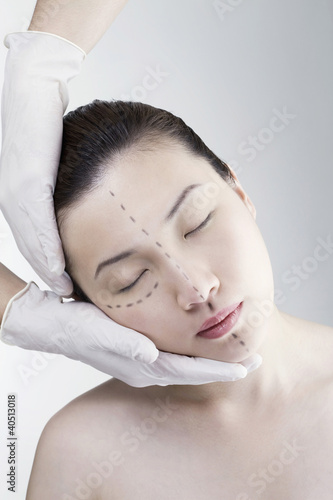 Photo: Woman with cosmetic surgery markings on her face Woman with cosmetic surgery markings on her face
