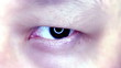The eye