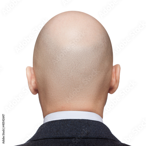 Photo: Bald man head Bald man head