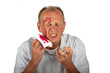 Wounded man with face full of blood