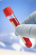 Laboratoire d'analyses médicales -Tube de sang