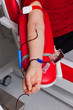 Blutabnahme beim Blutspenden in Blutlabor