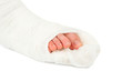 leg in a plaster cast