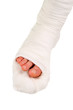 leg in a plaster cast