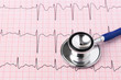 Photo: ECG printout and stethoscope ECG printout and stethoscope