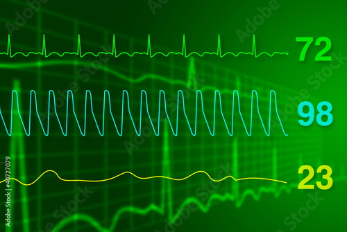 Illustration: Heart monitor Heart monitor