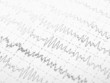 brain waves on encephalogramme eeg