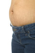 Stretch Mark