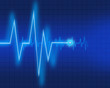 Electrocardiogram
