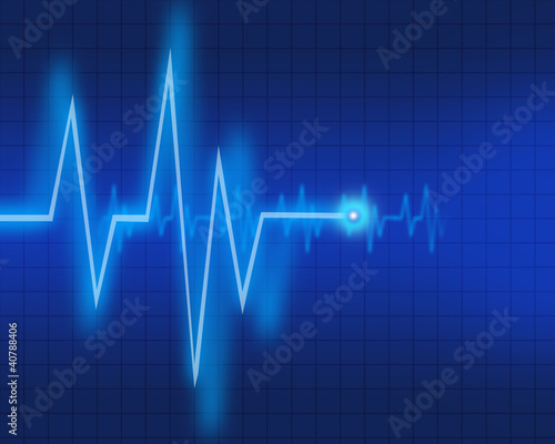 Illustration: Electrocardiogram Electrocardiogram