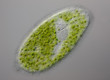 Paramecium bursaria - grünes Pantoffeltierchen - DIC