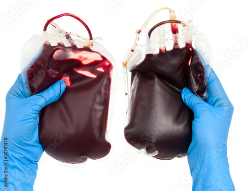 Photo: bag of blood in hand isolated bag of blood in hand isolated