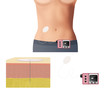 Diabetes Insulin Pump Illustration