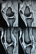 Röntgenbild Knie Details