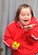 down syndrome