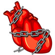 Heart attack