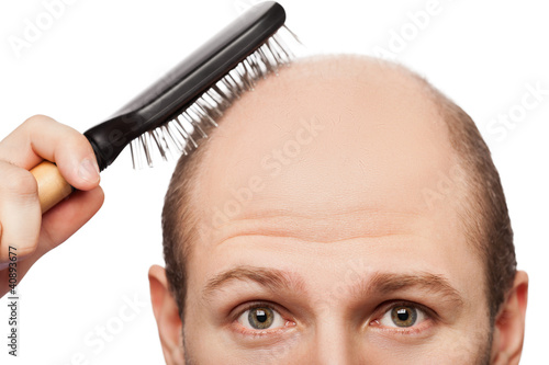 Photo: Bald man head Bald man head