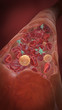 Kapillargefäß mit Erythrozyten, Leukozyten, Thrombozyten