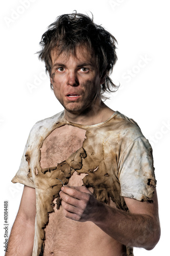 Photo: Burnt man Burnt man